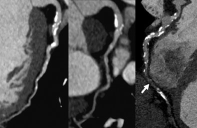 2010 02 09 14 54 06 367 Schoepf picture4x