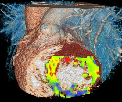 2010 02 09 14 54 14 132 Schoepf picture1x