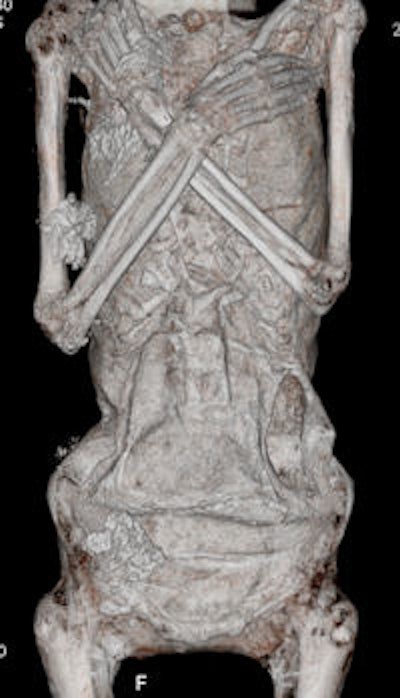 2010 02 10 14 45 22 934 Body 1 0 Without 200 Export