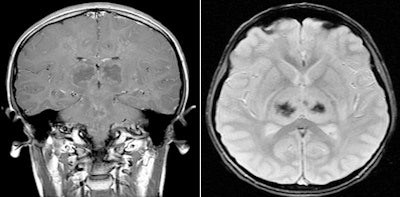 2010 02 11 14 13 55 529 Lyon 8 9 Combined 450