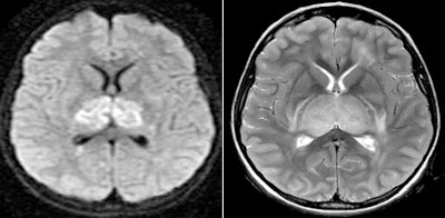 2010 02 11 14 14 02 949 Lyon 1a 5 Combined 450