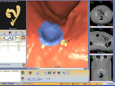 2010 02 12 14 15 17 11 Dachman ca Dgui