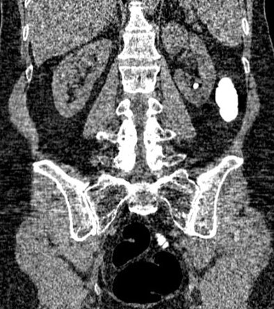 2010 02 12 17 50 28 741 Pickhardt 2 jpg