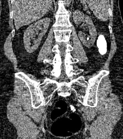 2010 02 12 17 50 28 741 Pickhardt 2 jpg