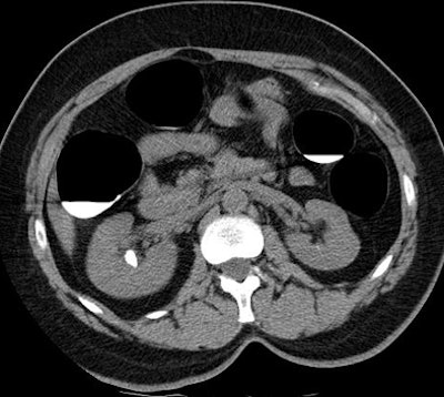 2010 02 12 17 50 32 0 Pickhardt 1 jpg