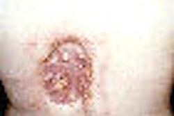 2010 02 17 16 01 45 740 Balter F4 Medium Thumbnail