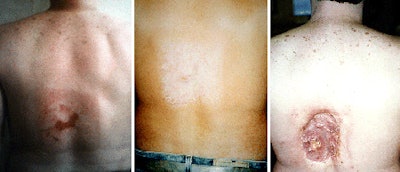 2010 02 17 16 27 32 150 Balter 342 Combined 450 V2