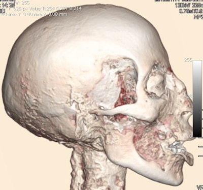 2010 02 10 14 45 20 460 Head Vr 28 394 Export