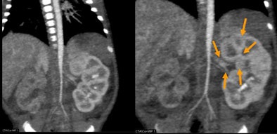 2010 02 24 17 08 05 53 Rogalla hypoplasia