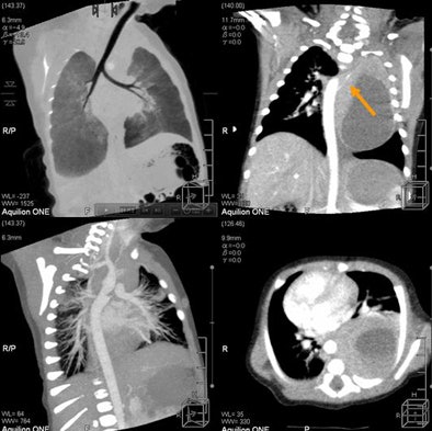 2010 02 24 17 08 25 437 Rogalla blastoma