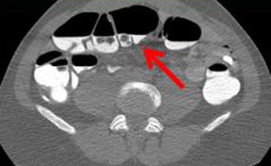 2010 03 07 11 49 59 874 Ferrari medium qualiity
