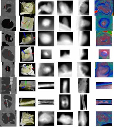 2010 03 09 17 36 56 824 Zhu projectedimagesb