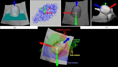 2010 03 09 17 36 59 28 Zhu localreference frameb