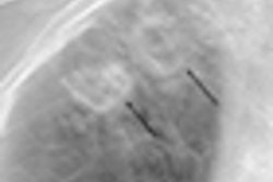 2010 03 18 15 08 14 381 2010 03 19 Tb Thumb