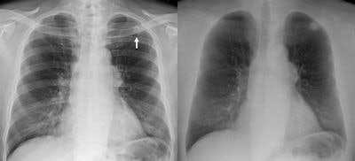 2010 03 19 10 59 02 801 2010 03 24 Dr Innovations Comp