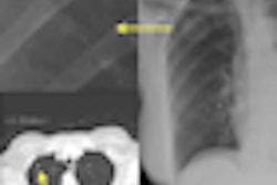 2010 03 24 13 07 19 617 Iqqa Chest 10 Thumb