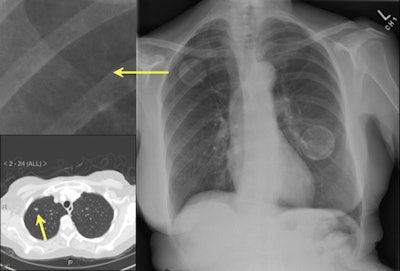 2010 03 24 13 07 24 440 Iqqa Chest 10 450