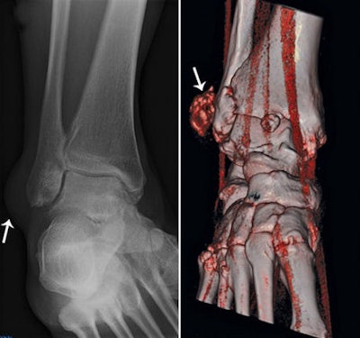 2010 03 29 10 58 45 637 Nicolaou 4a4b Combined 450