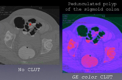 2010 04 01 14 26 21 566 Faggione pedunculated2 jpg