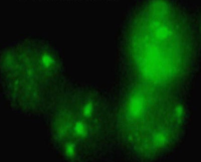 2010 04 02 13 04 47 918 Kufner dsb method bottom