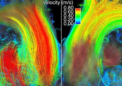 2010 04 02 15 37 26 214 Hope f2 middle