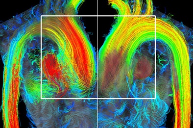 2010 04 02 15 37 33 330 Hope f1 top