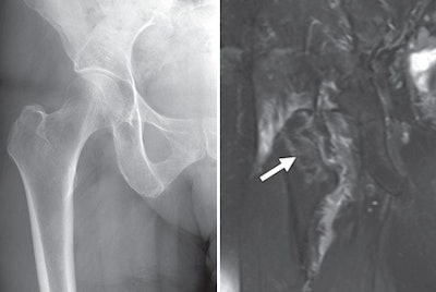 2010 04 06 11 17 00 699 Xray Mr Combined 450