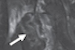 2010 04 06 11 17 03 958 Mr Image Thumb