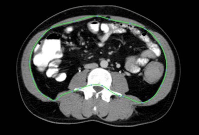 2010 04 13 14 35 42 889 Laoire fat top