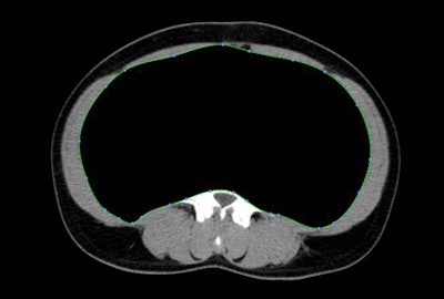 2010 04 13 14 35 48 622 Laoire fat bottom