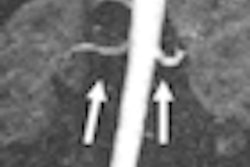 2010 04 16 12 39 46 48 Ce Mra Image 01 Thumb