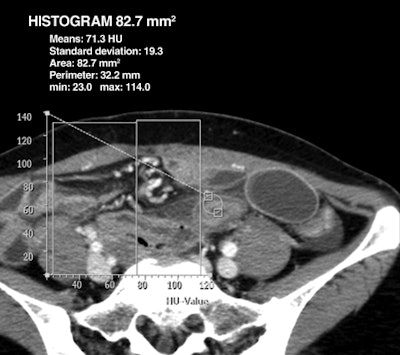 2010 04 16 14 26 51 925 Jing Top Comp 440