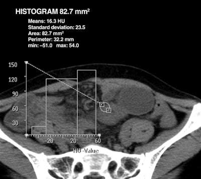 2010 04 16 14 26 55 591 Jing Bottom Comp 440