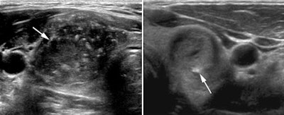 2010 04 20 10 51 53 505 Dighe Image1and2 450