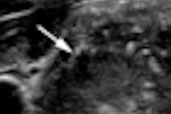 2010 04 20 10 59 30 781 Dighe Image1 Thumb