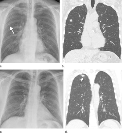2010 04 26 13 03 15 605 De Hoop Chest Screening 450
