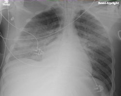 2010 04 29 15 04 21 893 Auntminnie Brice Ic Uxray Pix 250