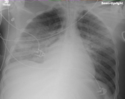 2010 04 29 15 04 21 893 Auntminnie Brice Ic Uxray Pix 250