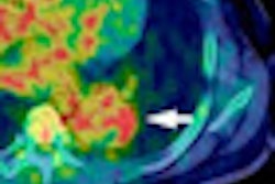 2010 04 30 14 44 57 798 Petct Image 01 Thumb