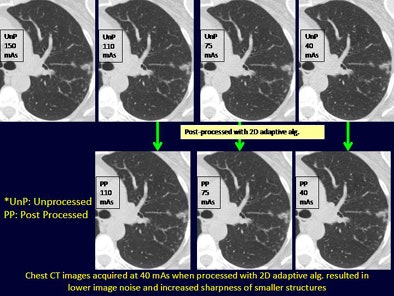 2010 05 07 10 14 51 452 Singh imagenoisechest top jpg