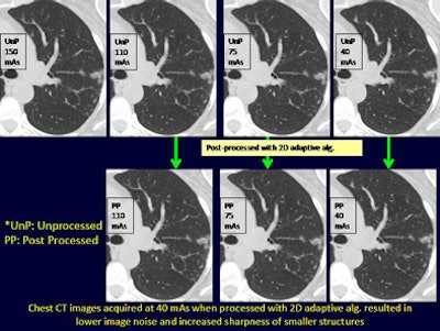 2010 05 07 10 14 51 452 Singh imagenoisechest top jpg