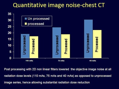 2010 05 07 10 14 53 281 Singh imagenoisechest bottom