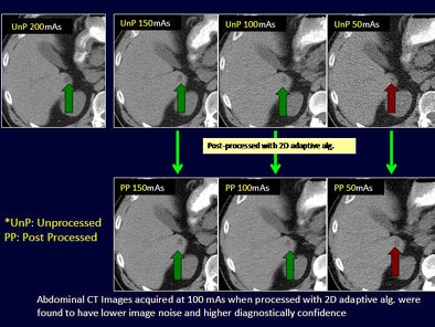 2010 05 07 10 14 56 576 Singh imagenoiseabdomen top jpg