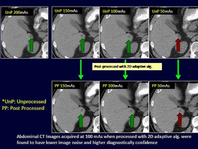 2010 05 07 10 14 56 576 Singh imagenoiseabdomen top jpg