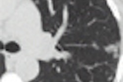 2010 05 07 10 24 23 176 Singh thumb Redo 70