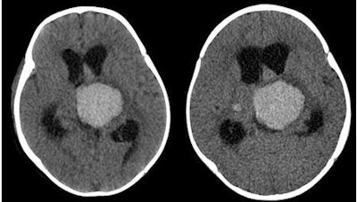 2010 05 07 13 10 36 712 Udayasankar Combined 450
