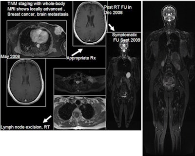 2010 05 10 10 12 58 440 Singh Top Bottom 450
