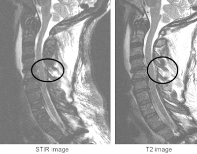 2010 05 11 10 44 41 872 Harris Blunt Mri 450