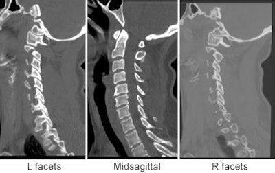 2010 05 11 10 44 45 526 Harris Blunt Ct 450