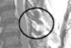 2010 05 11 10 59 20 788 Harris Blunt Mri Thumb